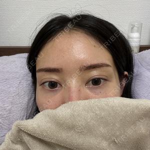 BiBiクリニック口コミ