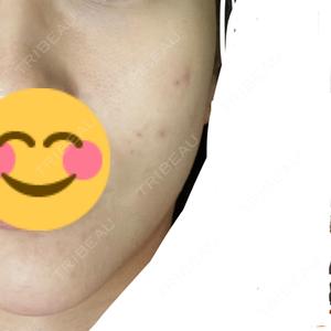 NEO Skin Clinic NEO Skin Clinic恵比寿口コミ