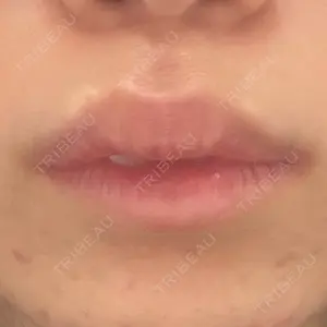 フィラークリニック フィラークリニック 新宿院口コミ