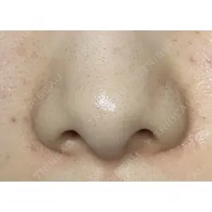 口コミ