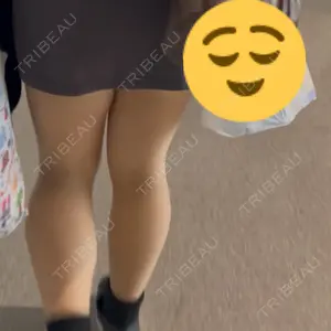 口コミ