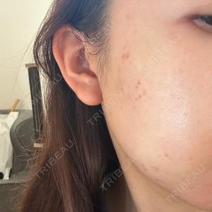ルラ美容クリニック ルラ美容クリニック 大宮院 / ルラスキンクリニック 大宮院口コミ