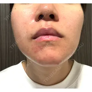 CIEL SKIN CLINIC（シエルスキンクリニック）口コミ