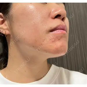 CIEL SKIN CLINIC（シエルスキンクリニック）口コミ
