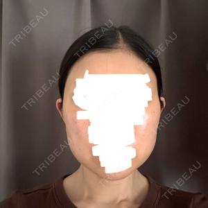 PRISM Beauty Clinic  PRISM Beauty Clinic 町田院口コミ