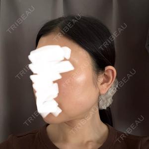 PRISM Beauty Clinic  PRISM Beauty Clinic 町田院口コミ