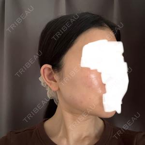 PRISM Beauty Clinic  PRISM Beauty Clinic 町田院口コミ