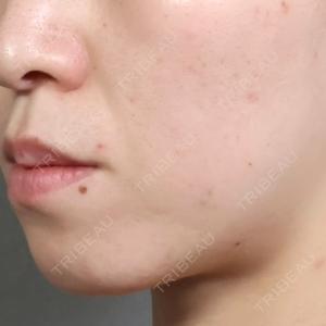 アリエル美容クリニック アリエル美容クリニック 郡山院口コミ
