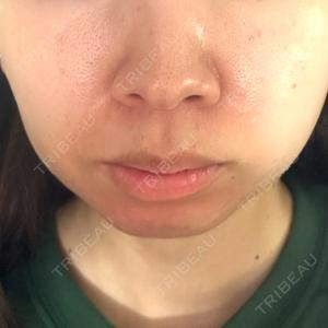 DMTC CLINIC DMTC美容皮膚科 大宮院口コミ