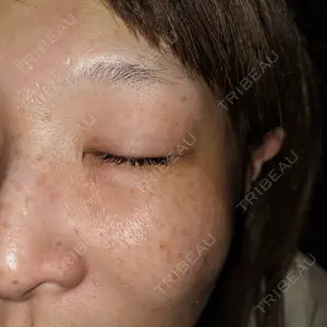 ルラ美容クリニック ルラ美容クリニック 横浜院口コミ