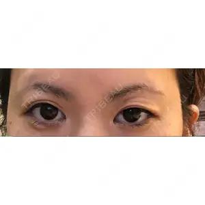 RG整形外科（旧リオン整形外科）口コミ