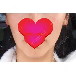 口コミ