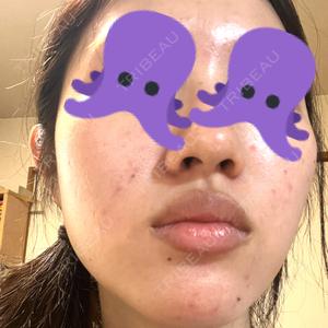 Fellez Clinic【フェルズクリニック】口コミ