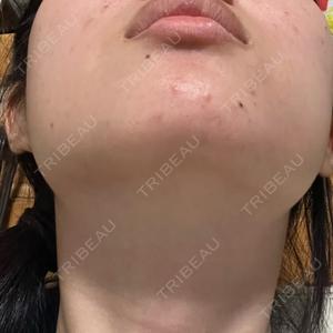 Fellez Clinic【フェルズクリニック】口コミ