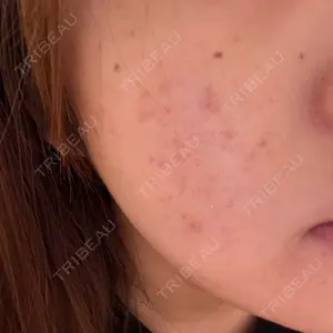 ルラ美容クリニック ルラ美容クリニック 横浜院口コミ