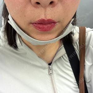 BiBiクリニック口コミ