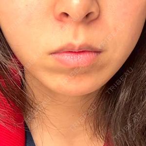 フォンタナクリニック天神口コミ