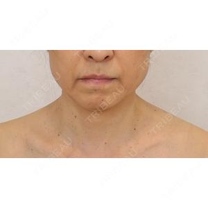 アリエル美容クリニック アリエル美容クリニック 横浜院口コミ