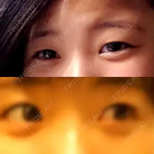 湘南美容クリニック 湘南美容クリニック 宇都宮院口コミ