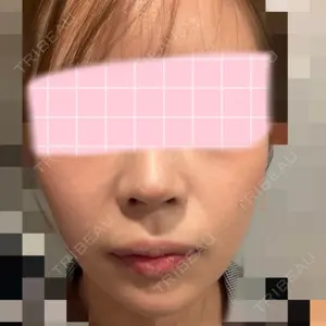 口コミ