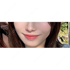 ルラ美容クリニック ルラ美容クリニック 上野院口コミ