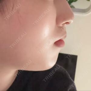 Chloe Cheongdam Clinic （クロエチョンダムクリニック）口コミ