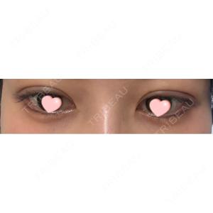 LUHO（ルホ）美容外科口コミ