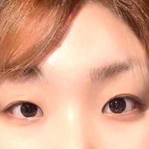 パルム美容クリニック口コミ
