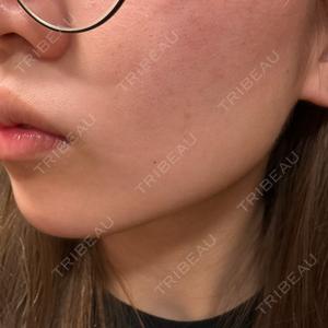 TCB東京中央美容外科 TCB東京中央美容外科 藤沢院口コミ