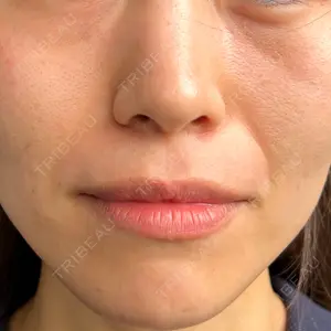 ルラ美容クリニック ルラ美容クリニック 福岡本院口コミ