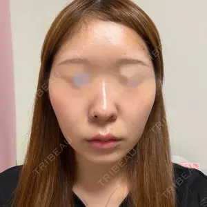 ハナビューティークリニック口コミ