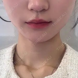 口コミ