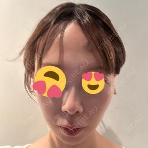 BiBiクリニック口コミ