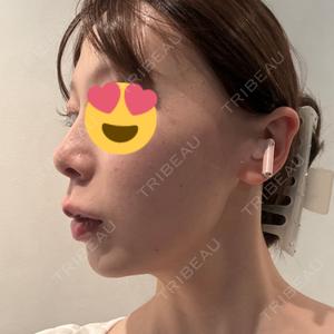 BiBiクリニック口コミ