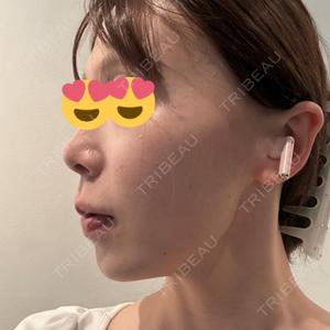 BiBiクリニック口コミ