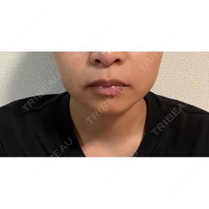DMTC CLINIC DMTC美容皮膚科 大宮院口コミ