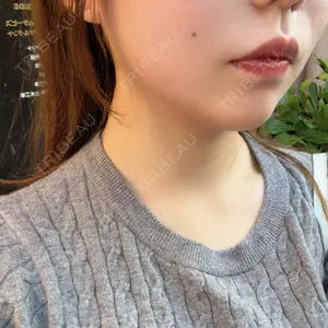 口コミ