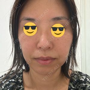 ビラビューティークリニック 博多美容外科/美容皮膚科 ビラビューティークリニック口コミ