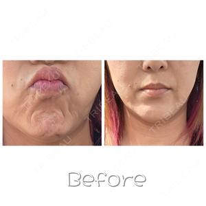 TAクリニック 札幌TAクリニック口コミ