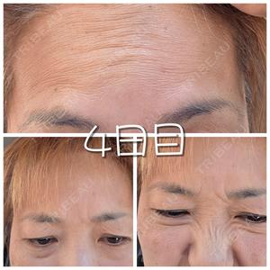 TAクリニック 札幌TAクリニック口コミ