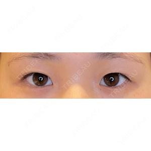 LOUIS CLINIC 二子玉川院【ルイクリニック】口コミ