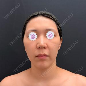 湘南美容クリニック 湘南美容クリニック 秋葉原院口コミ