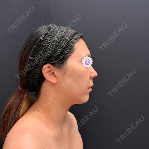 湘南美容クリニック 湘南美容クリニック 秋葉原院口コミ