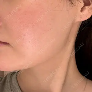BITO BEAUTY CLINIC BITO BEAUTY CLINIC口コミ
