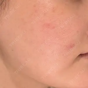 BITO BEAUTY CLINIC BITO BEAUTY CLINIC口コミ