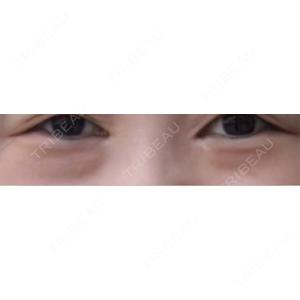銀座みゆき通り美容外科 銀座みゆき通り美容外科 大阪梅田院口コミ