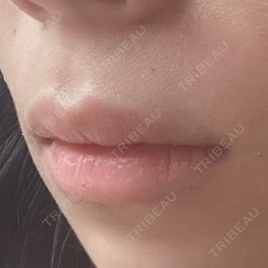 美容皮膚科 デュークリニック口コミ