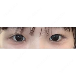 LUHO（ルホ）美容外科口コミ