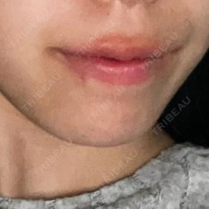 ルラ美容クリニック ルラ美容クリニック 千葉院 / ルラスキンクリニック 千葉院口コミ