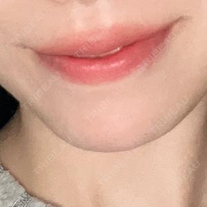 ルラ美容クリニック ルラ美容クリニック 千葉院 / ルラスキンクリニック 千葉院口コミ